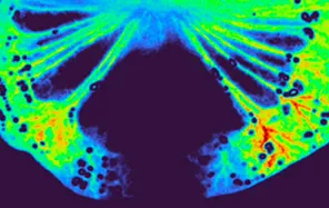 Laser speckle contrast imaging